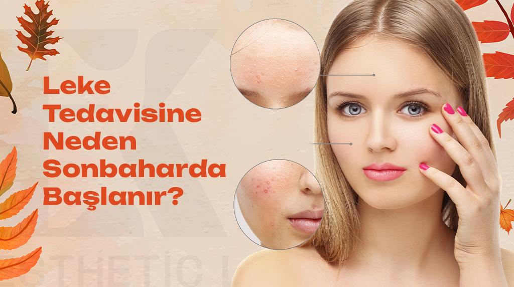 leke tedavisine sonbaharda başlanmasının sebebi